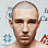 Anton 'King Kong' Lazebnov
